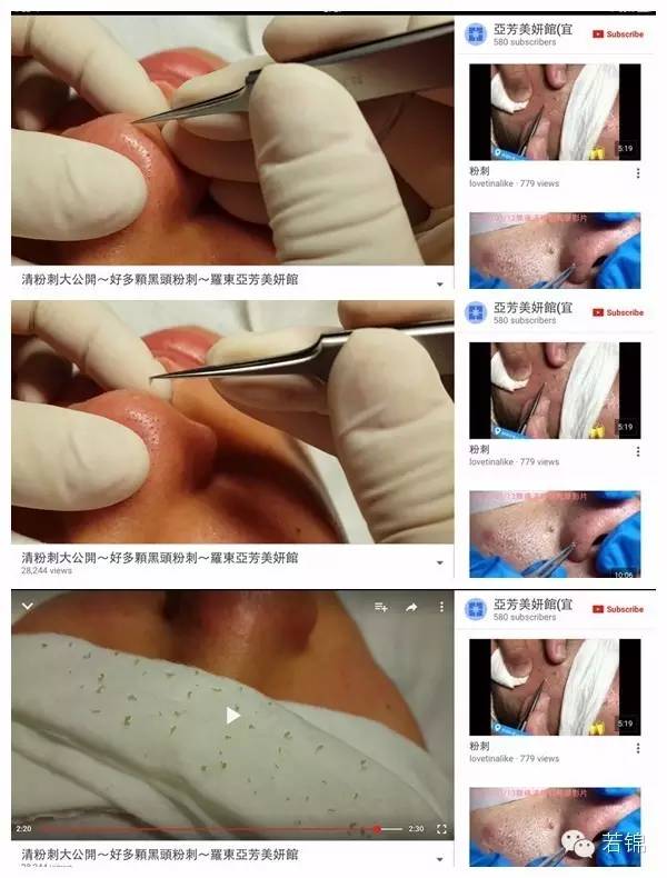 有挤黑头的工具吗,挤黑头工具好物分享