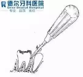 牙齿松动会导致牙疼吗,牙齿松动会引起腮帮子痛吗