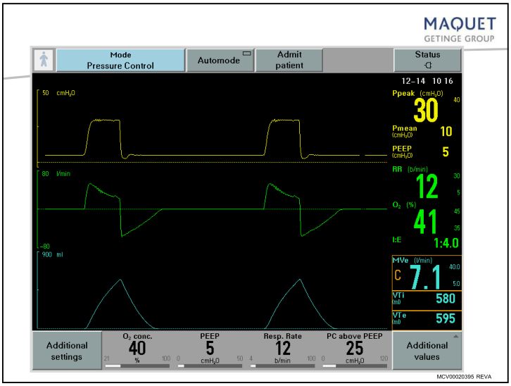 呼吸机基础知识最终版,呼吸机临床设置方法