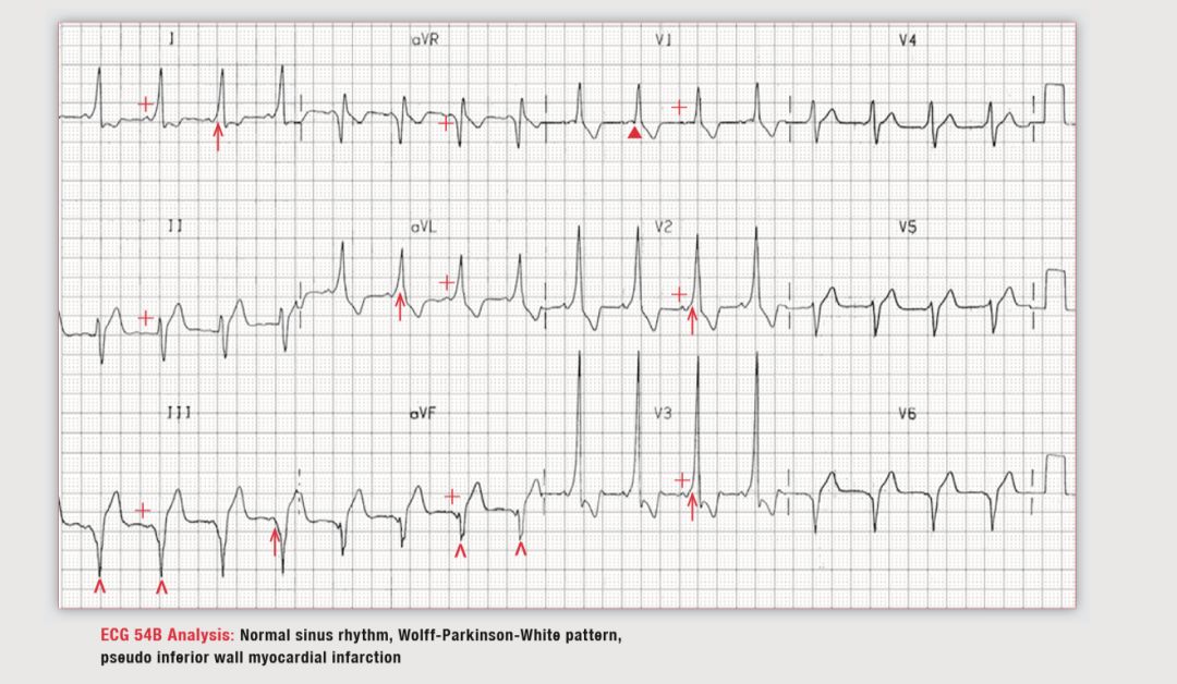 读心有术180期,读心有术视频讲解