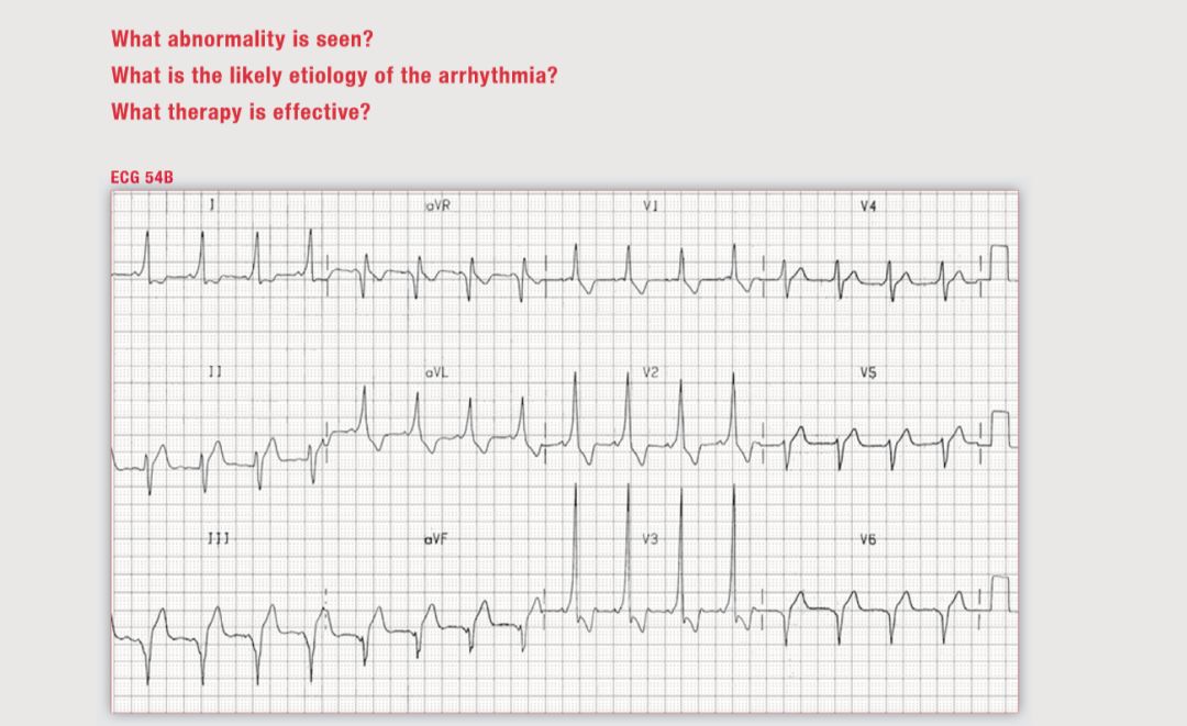 读心有术180期,读心有术视频讲解