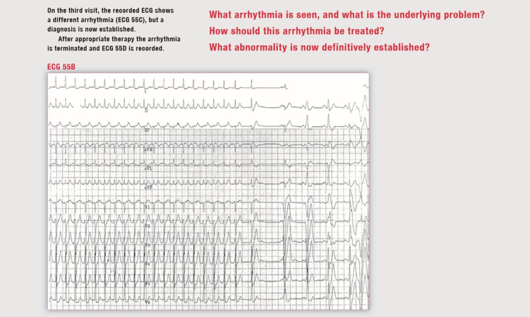 读心有术265,读心有术205期视频