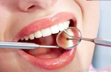 烤瓷牙表面掉瓷了对人身体有害吗,钴铬合金烤瓷牙对身体有害吗