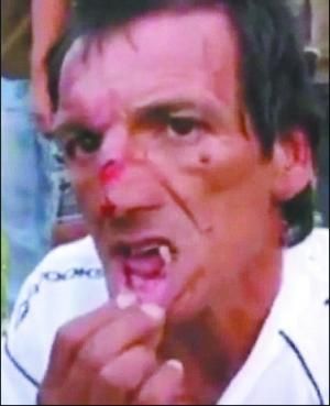 假球横行没人管么,假球猖獗