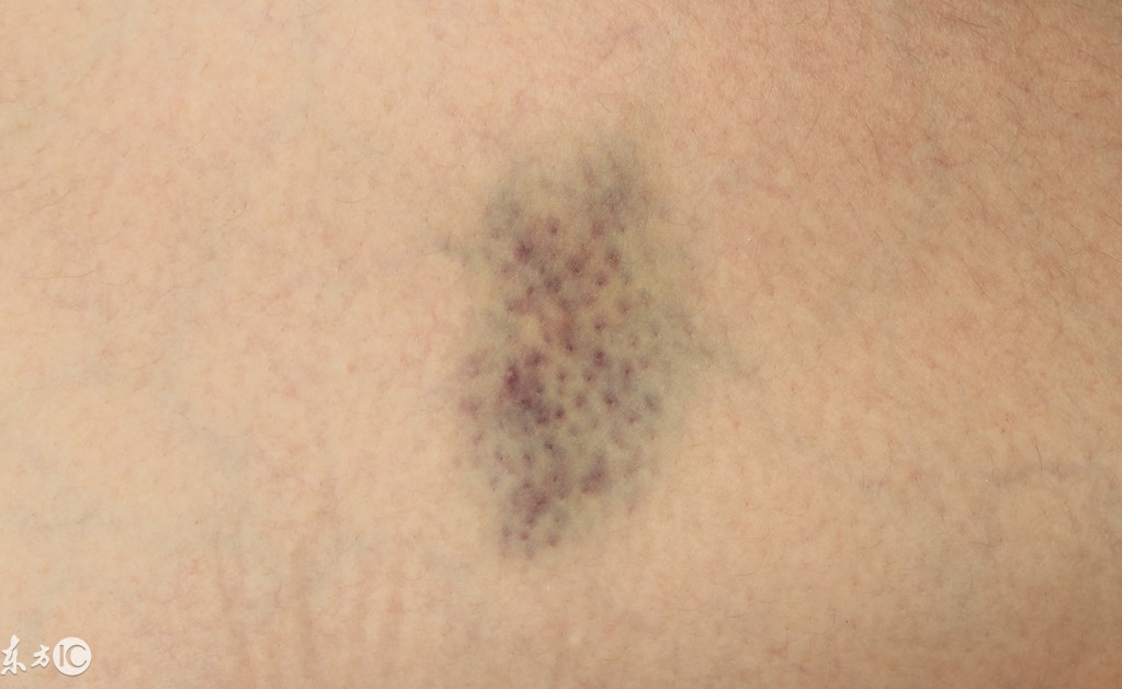 王奶奶在家不慎摔倒了,王奶奶穿高跟鞋摔跤