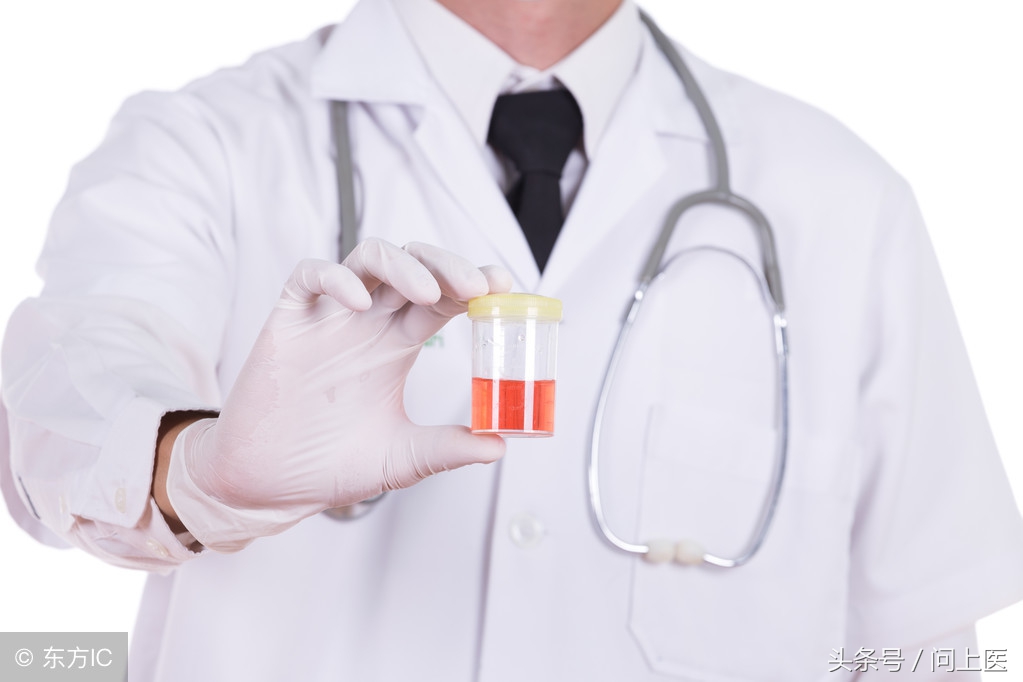 免疫球蛋白检查是查什么,免疫球蛋白检查是什么