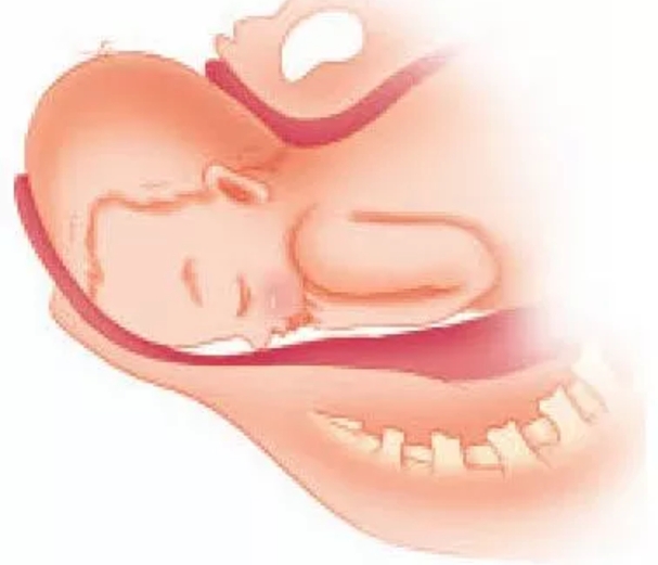 准妈妈必知分娩第二和第三产程