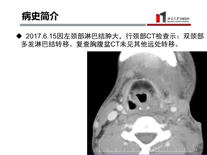 黑色素瘤中药治疗案例,黄柳治什么病最好