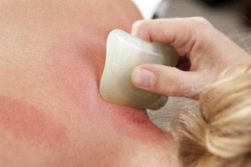 感冒喉咙痛刮痧刮哪个部位呢,感冒咳嗽刮痧刮什么部位