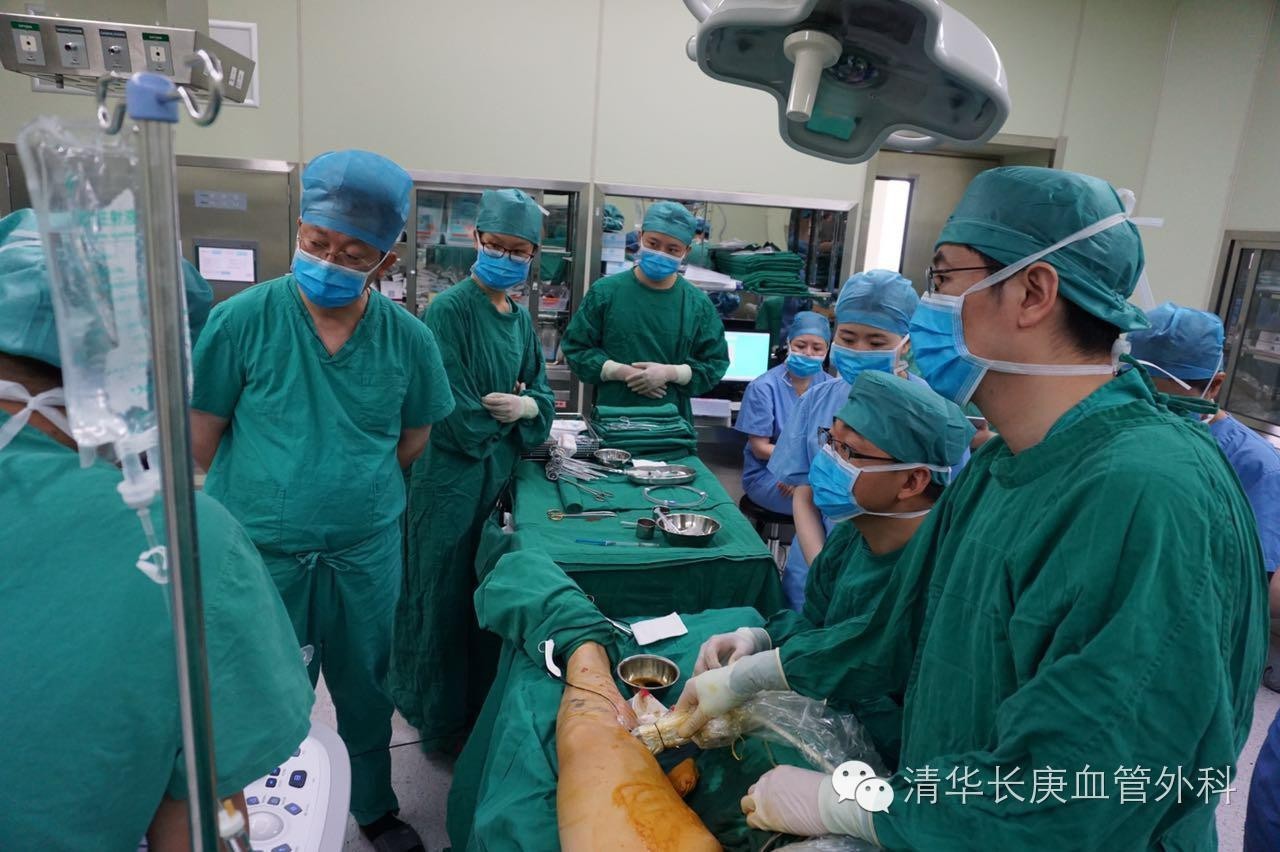 北京医院静脉曲张微创手术,清华长庚静脉曲张