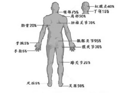 蔡少芬病好了吗,健康不得癌症的七个秘诀