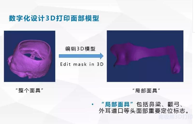 医学3d动画演示脑出血手术,3d演示脑出血治疗过程