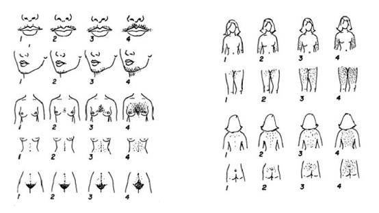 什么样的大姨妈算正常,妇产科专家咨询大姨妈