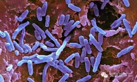 乳酸菌可以促进肠胃吸收吗,乳酸菌可以修复胃黏膜吗