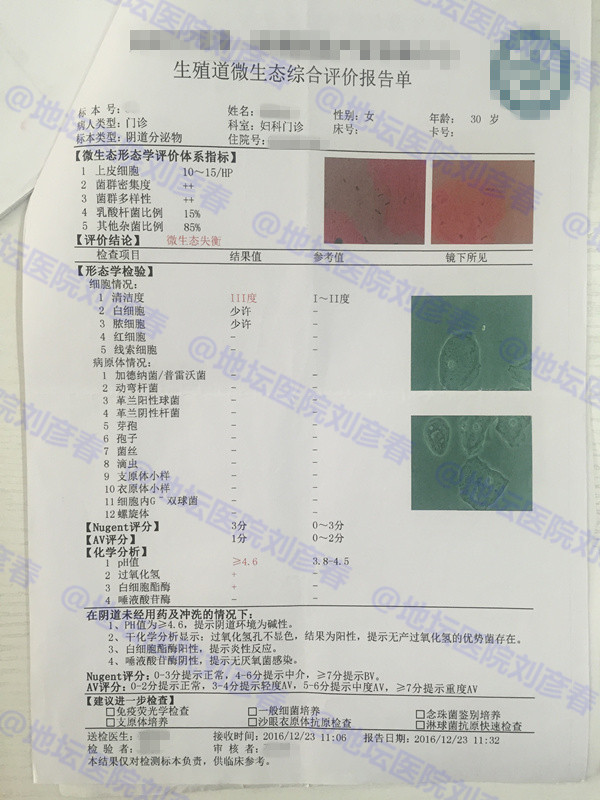 hpv感染分享治愈全过程,感染hpv发作过程的真实案例