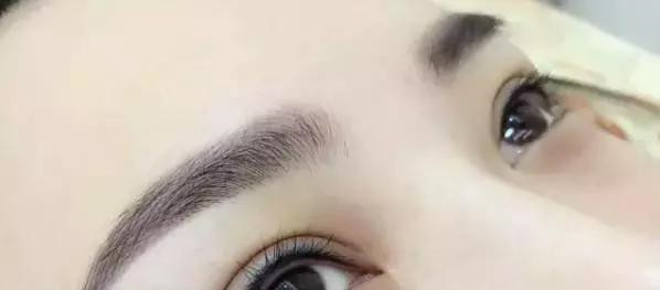 怎么让眉毛快速结痂掉痂,眉毛结痂掉痂修复过程