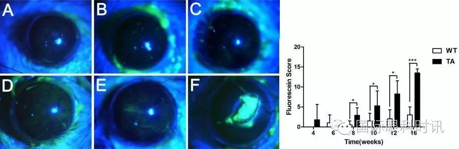 角膜会2016李炜教授:EDA基因突变鼠:一种新的睑板腺功能障碍相关性干眼动物模型