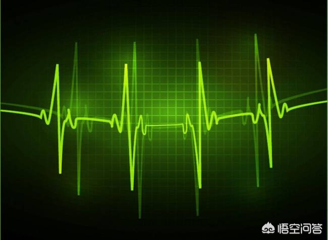 陈旧性心肌梗塞心电图都有q波吗,陈旧性心肌梗死心电图什么表现