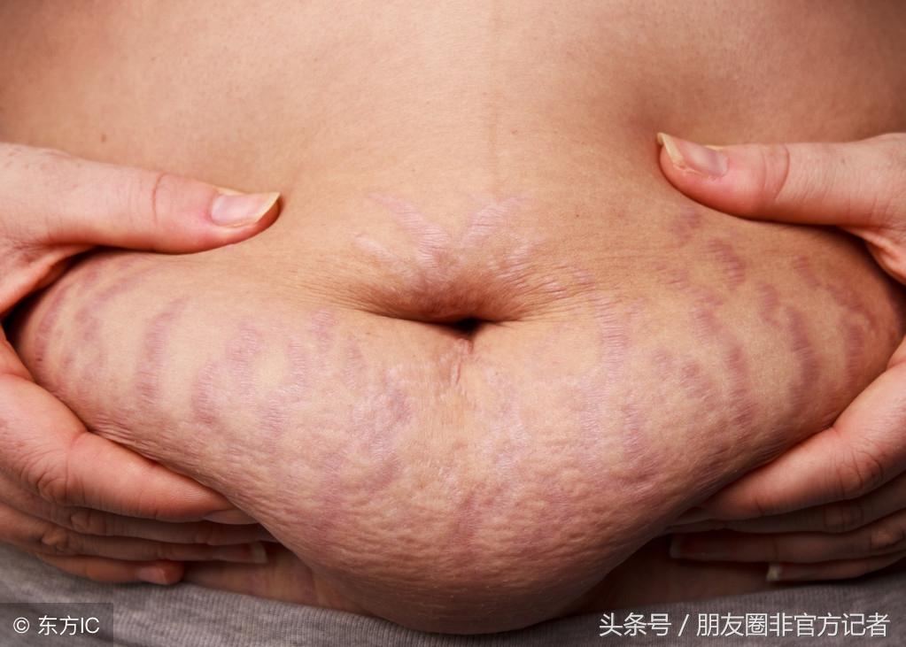 想孕期长胎不长肉这里有小技巧,想要孕期少长肉