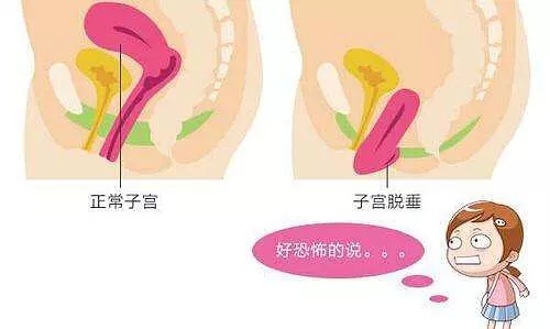 盆底肌和尿道括约肌的关系3d图解,盆底肌知识全解