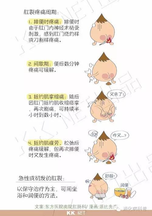 难以启齿的肛裂是怎么回事