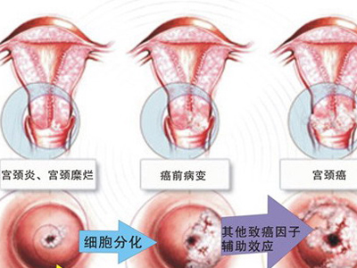 备孕的姐妹一定要注意了,想怀孕一定要避开这些备孕误区