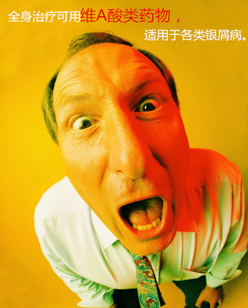 银屑病科普短剧,银屑病的文章