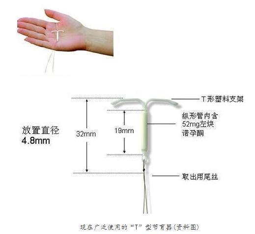 现代女性戴环过程痛苦吗,妇女戴环是啥样的