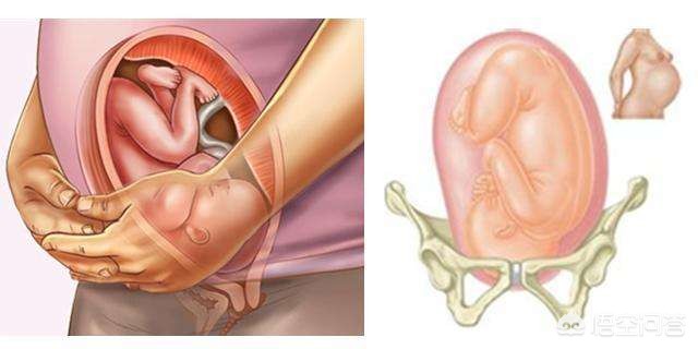 胎儿入盆，孕妈有哪些身体变化？