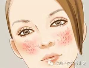 皮肤暗黄怎么办？听听专家怎么说