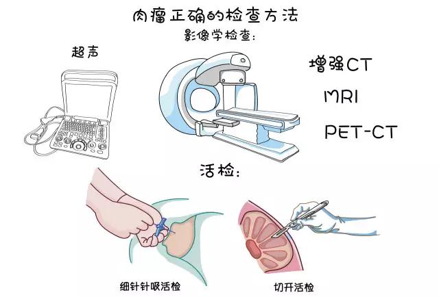 肉瘤良性和恶性误诊大不大,肉瘤为什么误诊为息肉