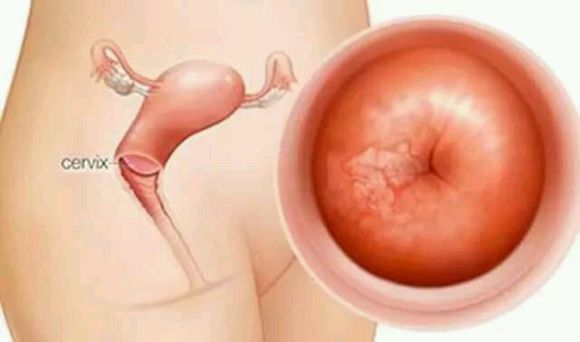 女性常见的妇科炎症有哪些,女性妇科炎症反复跟男人有关系吗