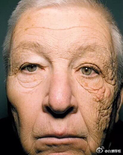 夏日美白必备,夏季美白大攻略