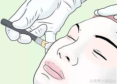 疤痕修复包括痘疤,刀疤跟痘疤哪种恢复快