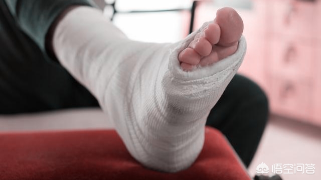 脚后跟骨粉碎性骨折有后遗症,脚后跟粉碎骨折的后遗症