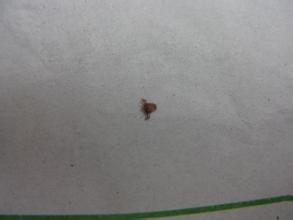 阴虱只有虫卵会传播吗,阴虱卵的传播途径