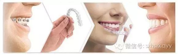 常见排齐牙齿的四大方法,牙齿拥挤重叠矫正过程