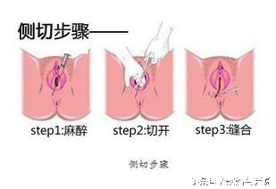 顺产真的有那么恐怖吗,顺产真有那么可怕么