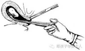 准妈产检生产都用过这些冰冷医疗仪器，看的心惊肉跳！