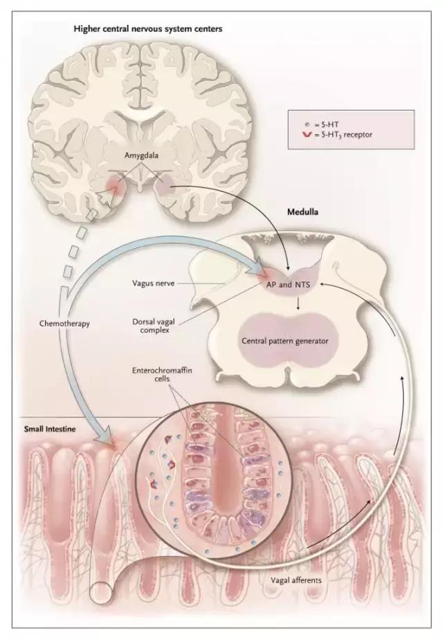 化疗后止吐药有什么副作用,化疗的止吐药有哪些副作用