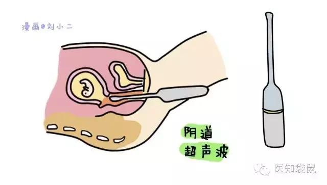 普通b超和肾b超检查范围一样吗,B超三维彩超区别