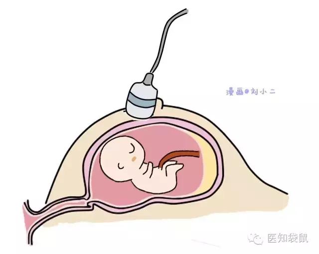 B超三维彩超区别,普通b超能看清胎儿颅内结构吗