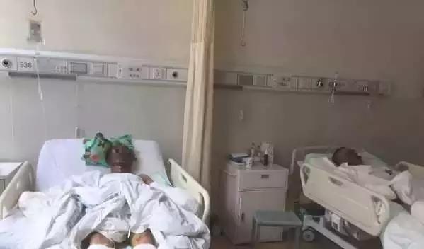 五佳|100公里外飘来的氢气球把父子俩烧得面目乌黑