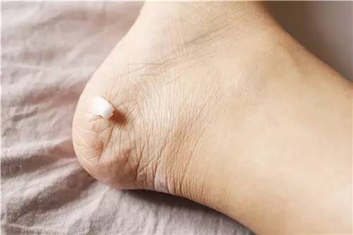 你的脚丫配得上新买的凉鞋吗?美足保养请戳这里