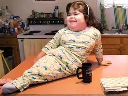 孕妇生下人鱼宝宝怎么回事,孕妇生下宝宝没手臂