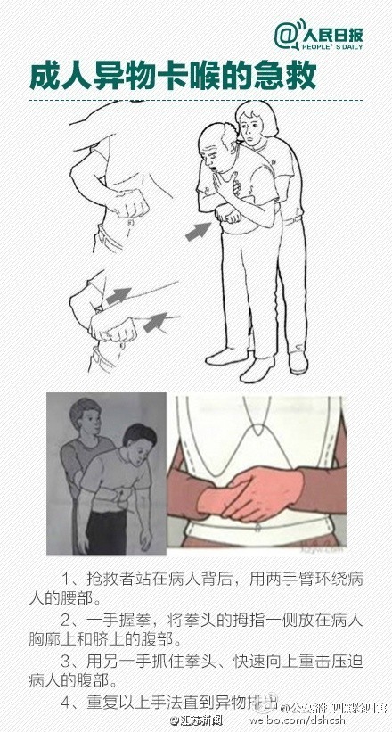 苏州老伯反复咳嗽竟因蟹壳卡喉6年！