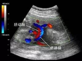 单脐动脉孕妈注意事项,单脐动脉的孕妈可以运动吗