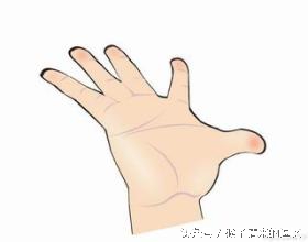 手足出汗症可以用什么中药泡,手足经常出汗怎么样根治