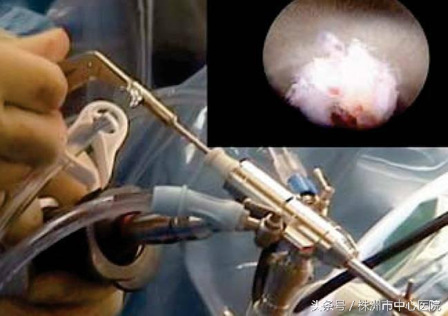 中心医院居然有“捉妖镜”，有患者亲眼目睹