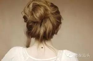 点痣会引发痣癌变吗,痣旁边长了小痣是不是癌变